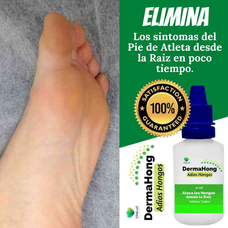 3X1 Dermahong - Elimina Hongos en 15 Día